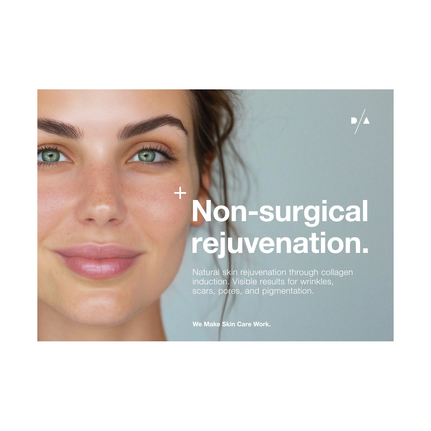  D/A Matrixneedling A2 poster